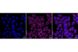 Immunocytochemical staining of HepG2 cells with G-rich RNA sequence binding factor 1 antibody(ABIN7798677), 1:1,000). (Recombinant GRSF1 抗体)