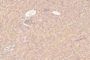 Immunohistochemistry (Paraffin-embedded Sections) (IHC (p)) image for anti-Kinesin Family Member 5B (KIF5B) antibody (ABIN7074440)