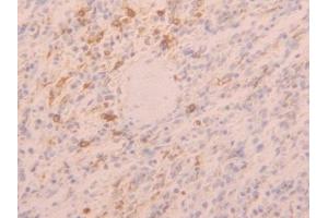 Detection of TLR5 in Human Spleen Tissue using Polyclonal Antibody to Toll Like Receptor 5 (TLR5) (TLR5 抗体  (AA 693-858))