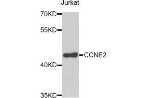 Western blot analysis of extracts of Jurkat cells, using CCNE2 antibody. (Cyclin E2 抗体)