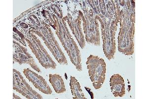 IHC analysis of DDR1 using anti-DDR1 antibody (ABIN7601407). (DDR1 抗体  (AA 341-909))