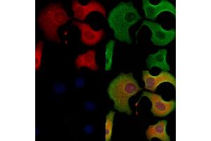 ABIN6263600 and ABIN6278494 staining Hela cells by IF/ICC. (Tetraspanin 9 抗体  (Internal Region))