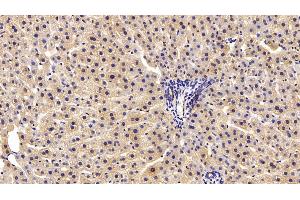 Detection of PRDX2 in Rat Liver Tissue using Polyclonal Antibody to Peroxiredoxin 2 (PRDX2) (Peroxiredoxin 2 抗体  (AA 6-164))