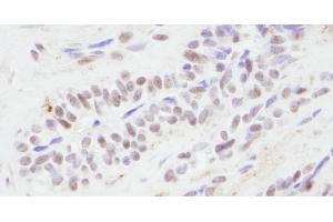 Immunohistochemistry (IHC) image for anti-CREB Binding Protein (CREBBP) (AA 2375-2425) antibody (ABIN7454618)