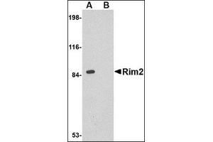 Western blot analysis of Rim2 in rat brain tissue lysate with this product at 1 μg/ml in the (A) absence or (B) presence of blocking peptide. (RIMS2 抗体  (Center))