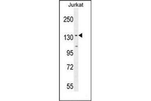 Western blot analysis of PPP1R3A Antibody  in Jurkat cell line lysates (35ug/lane).