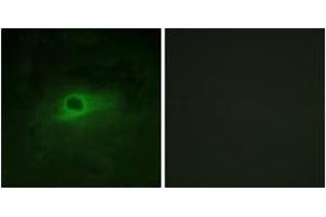 Immunofluorescence analysis of HeLa cells, using CSFR (Ab-809) Antibody. (CSF1R 抗体  (AA 781-830))