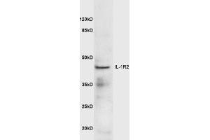 Mouse lung lysates probed with Anti-IL-1R2 Polyclonal Antibody  at 1:5000 90min in 37˚C. (IL1R2 抗体  (AA 301-398))