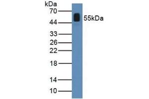 Detection of ANGPTL2 in Human Serum using Polyclonal Antibody to Angiopoietin Like Protein 2 (ANGPTL2) (ANGPTL2 抗体  (AA 267-493))