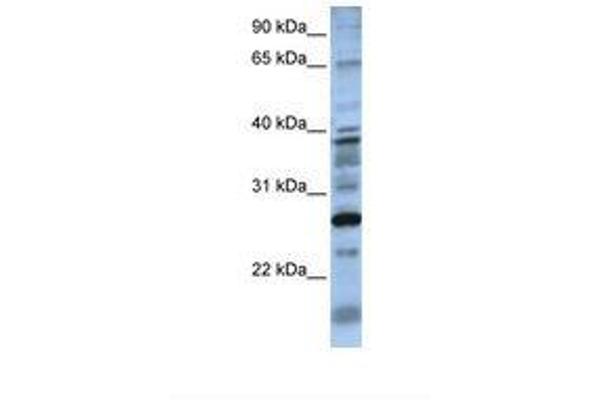 DOLPP1 抗体  (N-Term)
