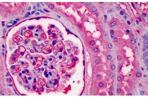 Human Kidney: Formalin-Fixed, Paraffin-Embedded (FFPE) (APOA1 抗体)