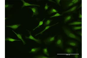 Immunofluorescence of purified MaxPab antibody to MAPKAPK3 on HeLa cell. (MAPKAP Kinase 3 抗体  (AA 1-382))