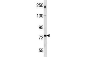 GCLC antibody western blot analysis in mouse bladder tissue lysate (GCLC 抗体  (AA 286-315))