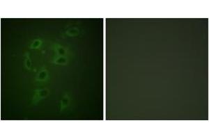Immunofluorescence analysis of HepG2 cells, using CBL (Phospho-Tyr700) Antibody. (CBL 抗体  (pTyr700))