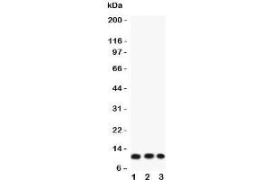 Western blot testing of Eotaxin 3 antibody and Lane 1:  COLO320;  2: A549;  3: HT1080 lysate. (CCL26 抗体  (AA 24-94))
