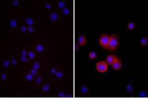 Human pancreatic carcinoma cell line MIA PaCa-2 was stained with Mouse Anti-Human CD44-UNLB, and DAPI. (驴 anti-小鼠 IgG (Heavy & Light Chain) Antibody (FITC) - Preadsorbed)