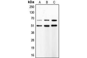 Western blot analysis of MMP8 expression in SJRH30 (A), PMNL (B), Sw620 (C) whole cell lysates. (MMP8 抗体  (C-Term))