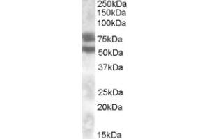 Image no. 1 for anti-Dachshund 1 (DACH1) (Internal Region) antibody (ABIN375187) (DACH1 抗体  (Internal Region))