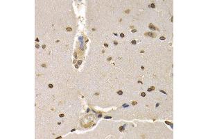 Immunohistochemistry of paraffin-embedded rat brain using HIST4H4 antibody at dilution of 1:200 (400x lens). (Histone H4 抗体)
