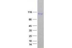 ELP2 Protein (Myc-DYKDDDDK Tag)