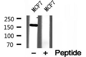 Western blot analysis of extracts of MCF7 cells, using ZCCHC11 antibody. (ZCCHC11 抗体  (Internal Region))