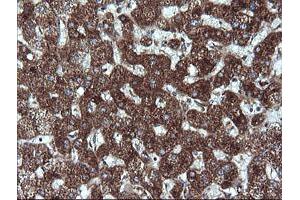 Immunohistochemistry (IHC) image for anti-Acetyl-CoA Acyltransferase 2 (ACAA2) antibody (ABIN1495727) (ACAA2 抗体)