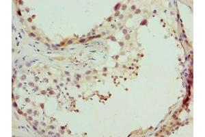 Immunohistochemistry of paraffin-embedded human testis tissue using ABIN7148653 at dilution of 1:100 (CPXCR1 抗体  (AA 1-301))