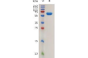 SDS-PAGE (SDS) image for Carbonic Anhydrase 12 (CA12) (AA 25-301) protein (Fc Tag) (ABIN7491097)