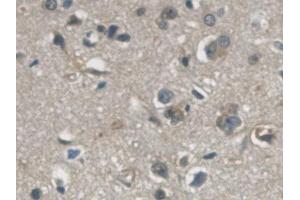 Immunohistochemistry (IHC) image for anti-Glyceraldehyde-3-Phosphate Dehydrogenase (GAPDH) (AA 2-148) antibody (ABIN7426391)