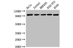 Western Blot Positive WB detected in: Hela whole cell lysate, Jurkat whole cell lysate, HEK293 whole cell lysate, NIH/3T3 whole cell lysate, A549 whole cell lysate All lanes: DDR2 antibody at 3. (DDR2 抗体  (AA 447-540))