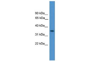 WB Suggested Anti-C4orf19 Antibody Titration:  0. (C4orf19 抗体  (N-Term))