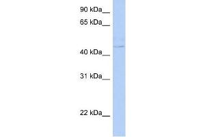 PSCD4 antibody used at 1 ug/ml to detect target protein. (Cytohesin 4 抗体  (N-Term))