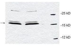 Western blot using  affinity purified anti-Pin1 antibody to detect endogenous Pin1 in HeLa whole cell lysates. (PIN1 抗体  (Internal Region))