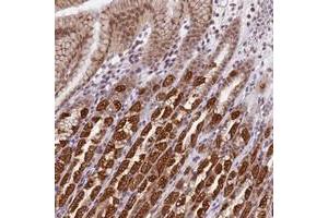 Immunohistochemical staining of human stomach with TMEM104 polyclonal antibody  shows strong cytoplasmic and nuclear positivity in glandular cells at 1:200-1:500 dilution. (TMEM104 抗体)
