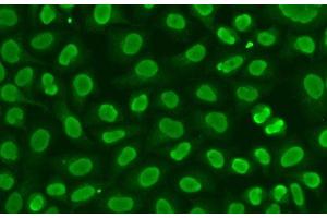 Immunofluorescence analysis of HeLa cells using FEN1 Polyclonal Antibody (FEN1 抗体)