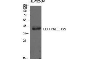 Western Blot (WB) analysis of HepG2-UV cells using Lefty Polyclonal Antibody. (LEFTY1 抗体  (Internal Region))
