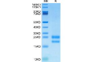 VEGF121 Protein (His-Avi Tag,Biotin)