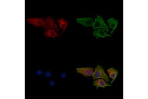 ABIN7094275 and ABIN7098322 staining HepG2 cells by IF/ICC. (HIBCH 抗体  (Internal Region))