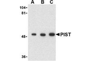 AP20060PU-N PIST antibody staining of Rat Colon Cell Lysate by Western Blotting at (A) 1 and (B) 2 and (C) 4 μg/ml.