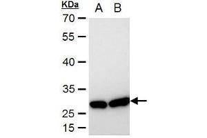 Western Blotting (WB) image for anti-Heat Shock 27kDa Protein 1 (HSPB1) (Center) antibody (ABIN2854951)