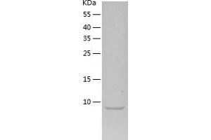 Western Blotting (WB) image for Pro-Brain Natriuretic Peptide (NT-ProBNP) (NT-ProBNP) (AA 27-76) protein (His tag) (ABIN7124559)