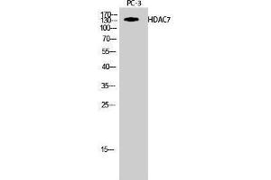 Western Blotting (WB) image for anti-Histone Deacetylase 7 (HDAC7) (Tyr721) antibody (ABIN3184990) (HDAC7 抗体  (Tyr721))