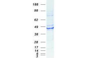 Western Blotting (WB) image for Nuclear Receptor Subfamily 2, Group F, Member 6 (NR2F6) protein (Myc-DYKDDDDK Tag) (ABIN2727591)