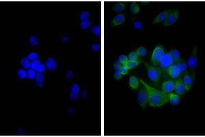 Human pancreatic carcinoma cell line MIA PaCa-2 was stained with Mouse Anti-Cytokeratin 18-UNLB, and DAPI. (山羊 anti-小鼠 Ig (Chain kappa) Antibody (Biotin))