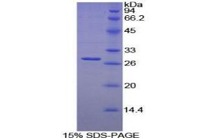 SDS-PAGE analysis of Mouse LILRB3 Protein. (LILRB3 蛋白)