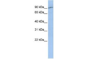 WB Suggested Anti-SLC15A2  Antibody Titration: 0. (SLC15A2 抗体  (Middle Region))
