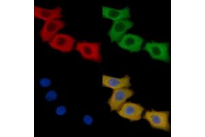 Integrin alpha 3 Mouse Monoclonal Antibody staining HepG2 cells by IF/ICC.