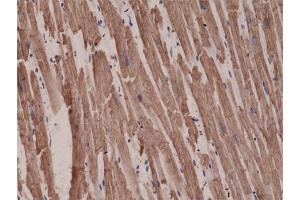 Immunohistochemical staining (Formalin-fixed paraffin-embedded sections) of human heart with ACTC1 monoclonal antibody, clone RM257  at a 1:1000 dilution. (ACTC1 抗体  (N-Term))