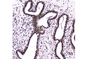IHC analysis of PARN using anti-PARN antibody . (PARN 抗体  (AA 1-301))