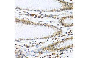 Immunohistochemistry of paraffin-embedded human stomach using IFI44 antibody (ABIN6135120, ABIN6142168, ABIN6142169 and ABIN6224213) at dilution of 1:100 (40x lens). (IFI44 抗体)